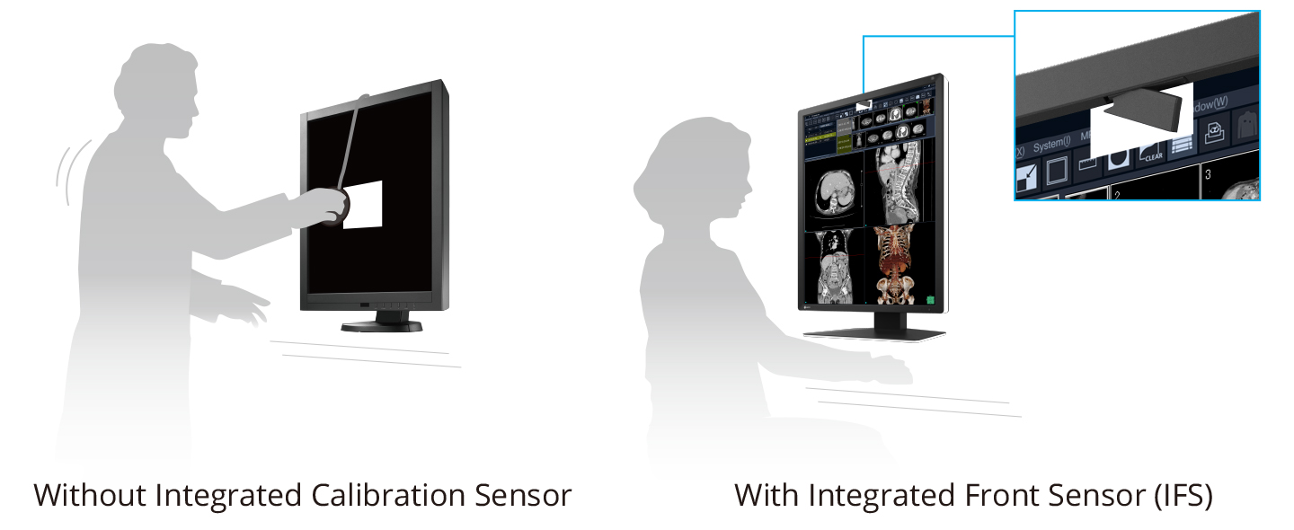 IntegratedFrontSensor